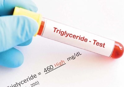 امگا3 برای کاهش چربی خون: راهکاری برای کنترل تری گلیسیرید